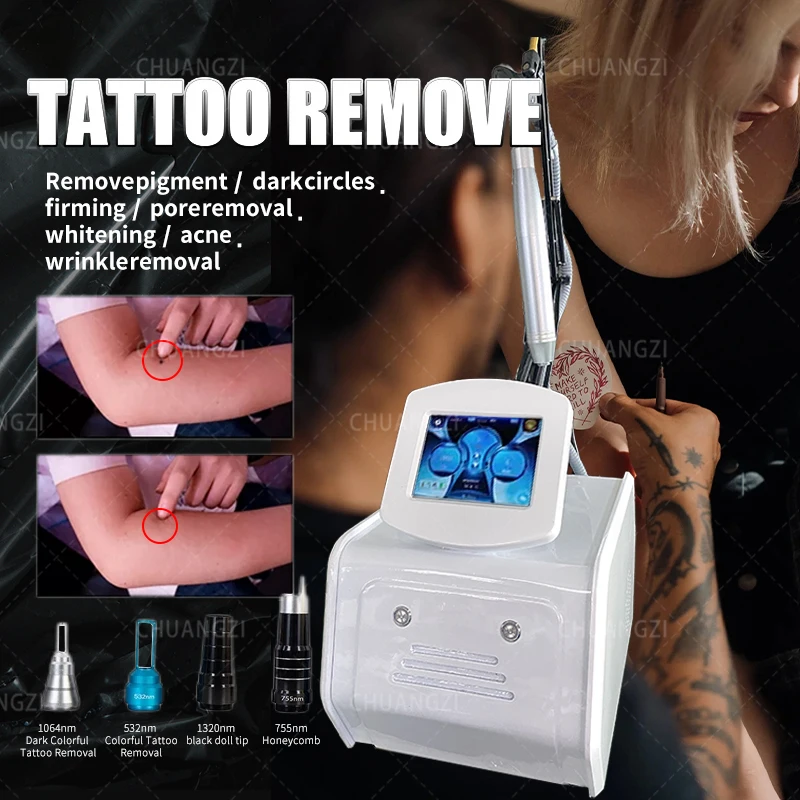 

Latest Q-Switch Nd Yag Laser 1064nm532nm1320nm Tattoo Removal Pigmentation Removal Picosecond Laser- Machine Duty Free