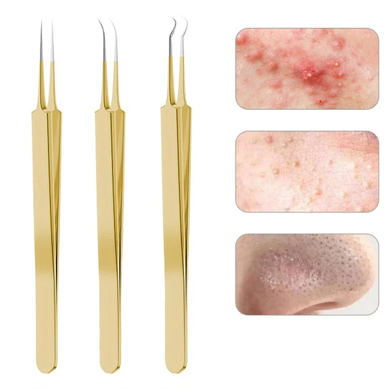 9/7/5PCS Acne Blackhead Removal Needles Kits Gold Color Stainless Steel Black Spot Blemish Pimple Cleansing Tool Face Skin Care