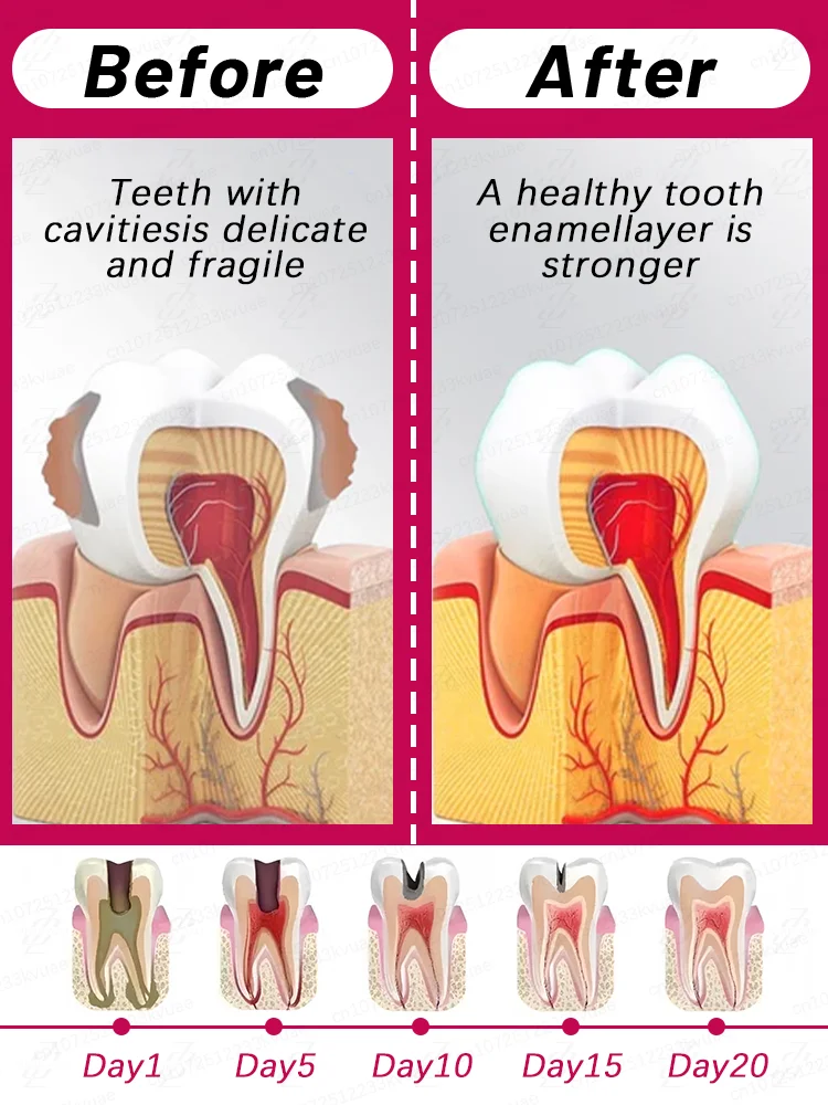 ★Dentist Recommended Product★ Dental Clinic Plaque Removal Toothpaste