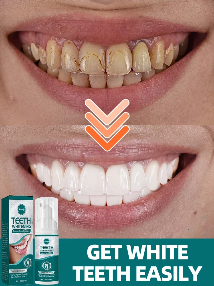 

Teeth Cleaning Has A Whitening Effect, Which Is Effective For Deep Stains Tooth Whiten Care