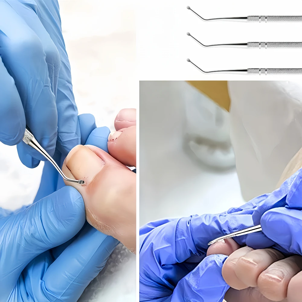 1/3/5 piezas Herramientas de pedicura de acero inoxidable, cuchara curva para limpieza profunda de ranuras de uñas, mango antideslizante, herramienta para levantar uñas encarnadas