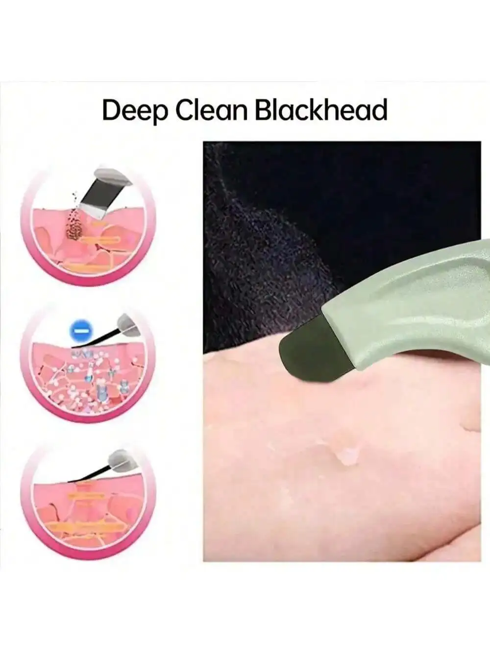 أداة إزالة الرؤوس السوداء الرئيسية للتنظيف العميق متوافقة مع كريم الطين وزيت التنظيف لأداة تجميل الوجه لتنظيف المسام #5