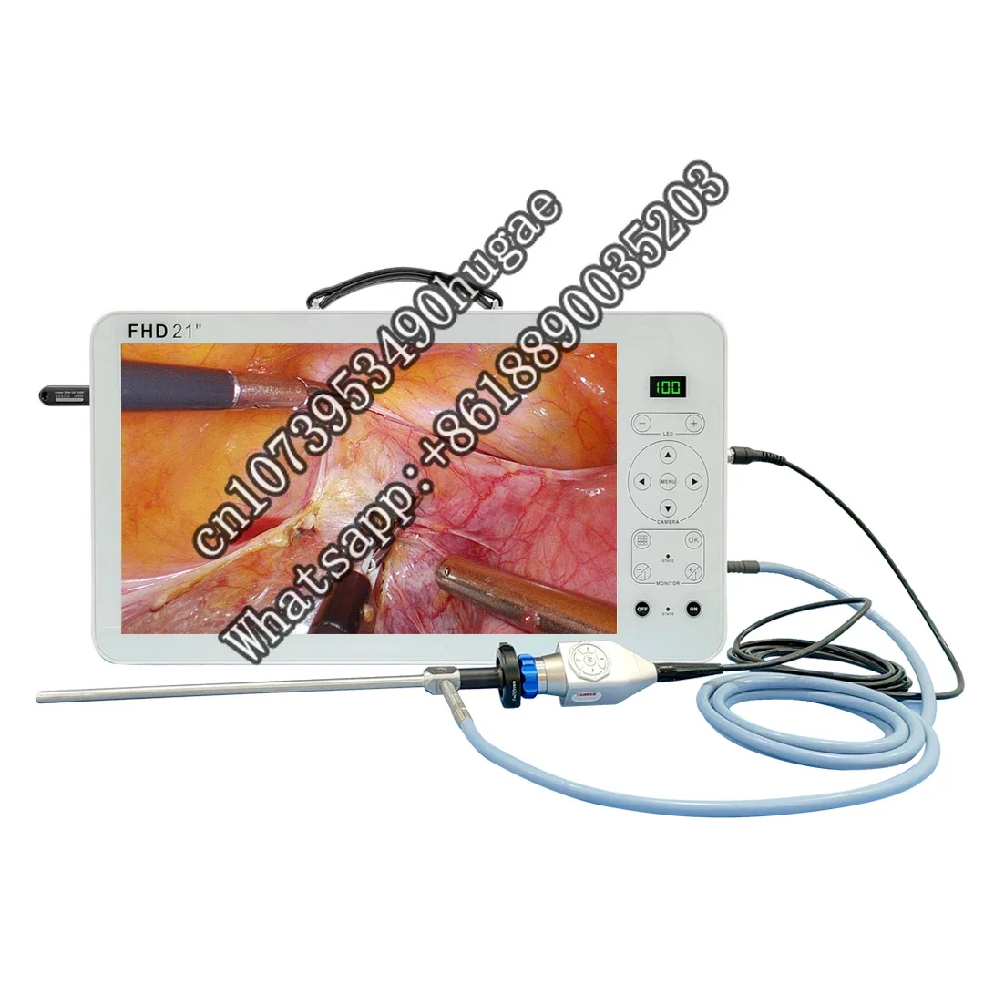 shrek factory new product 21 inch portable full hd medical imaging equipment for laparoscopic hysteroscopic surgery