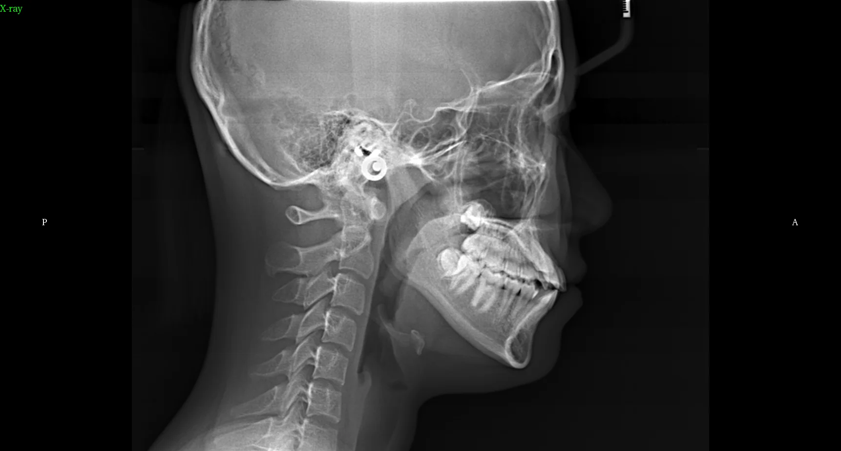 Dentals instruments mouth unit digital cbct 3D OPG  x ray CT scanner machine MSLDX20 With Cephalometric Function