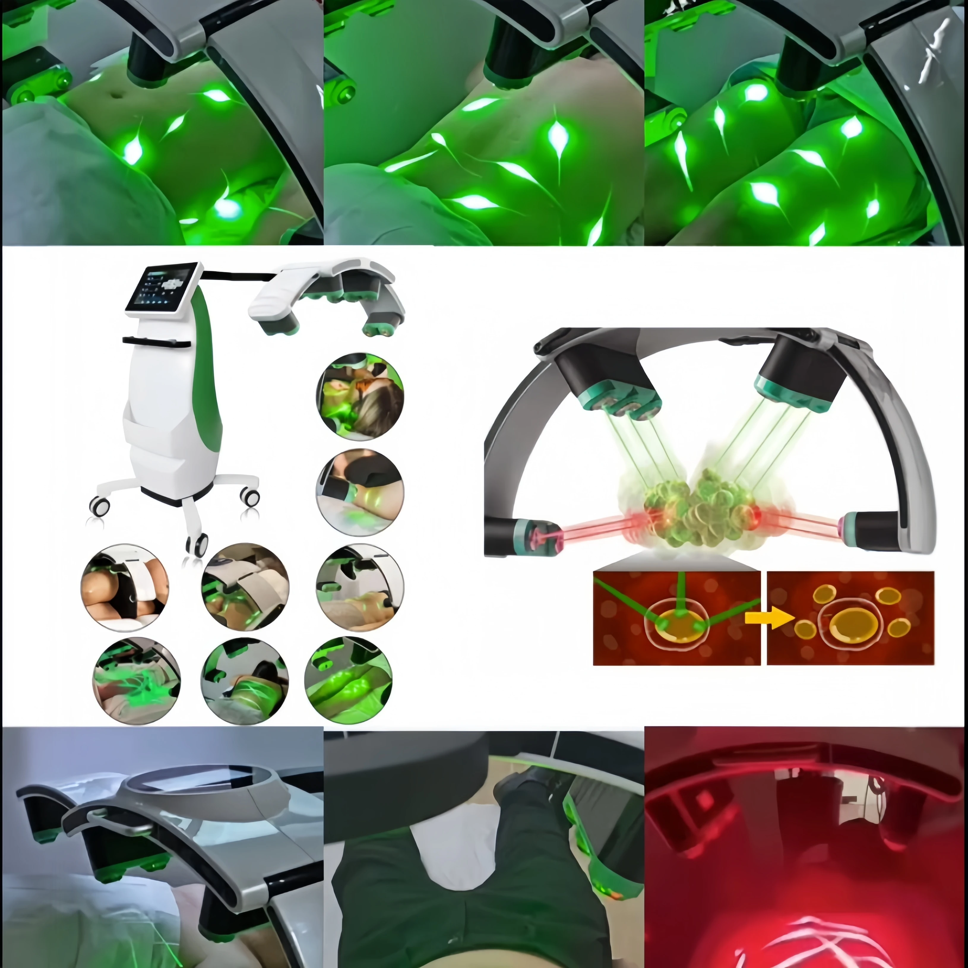 

10D Emerald lose Weight Machine 532nm Green LightBurn Fat Body Slimming Body Shaping Beauty SPA Machine