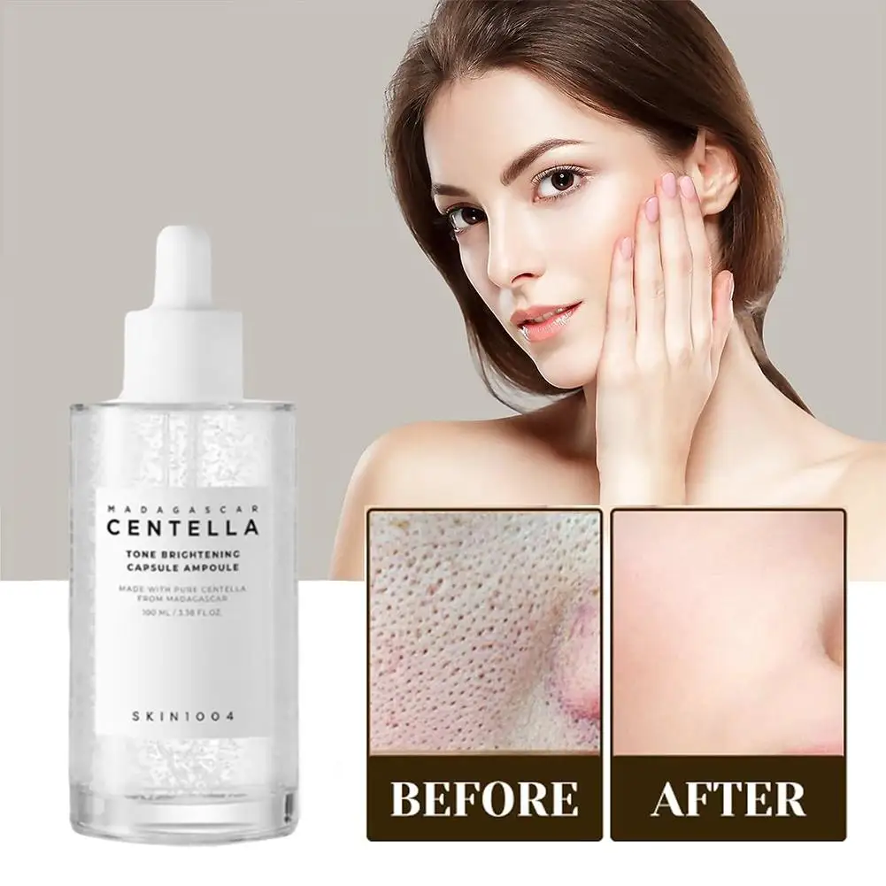 Original Centella Toner Serum Centella Asiatica Ampulle Essence befeuchten für empfindliche Haut Akne entfernen Gesichtspflege Lotion Pflege