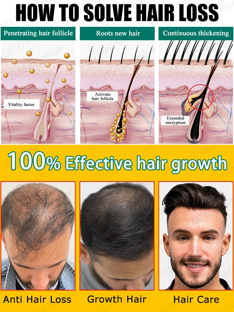 Hair Growth Essential Oil, Effectively Repair Baldness and Hair Loss