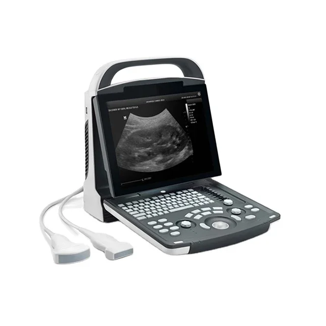 Best Price Mindray Ultrasound Ultrasound Machine/hand-carried Portable 3d 4d Color Ultrasound Doppler For Hospital