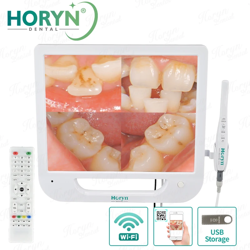 Dental Endoscope 17inch LCD Monitor SONY CCD HD Camera 6LED Wifi Digital Radio Dentistry Intra Oral Camera 15 Megapixel