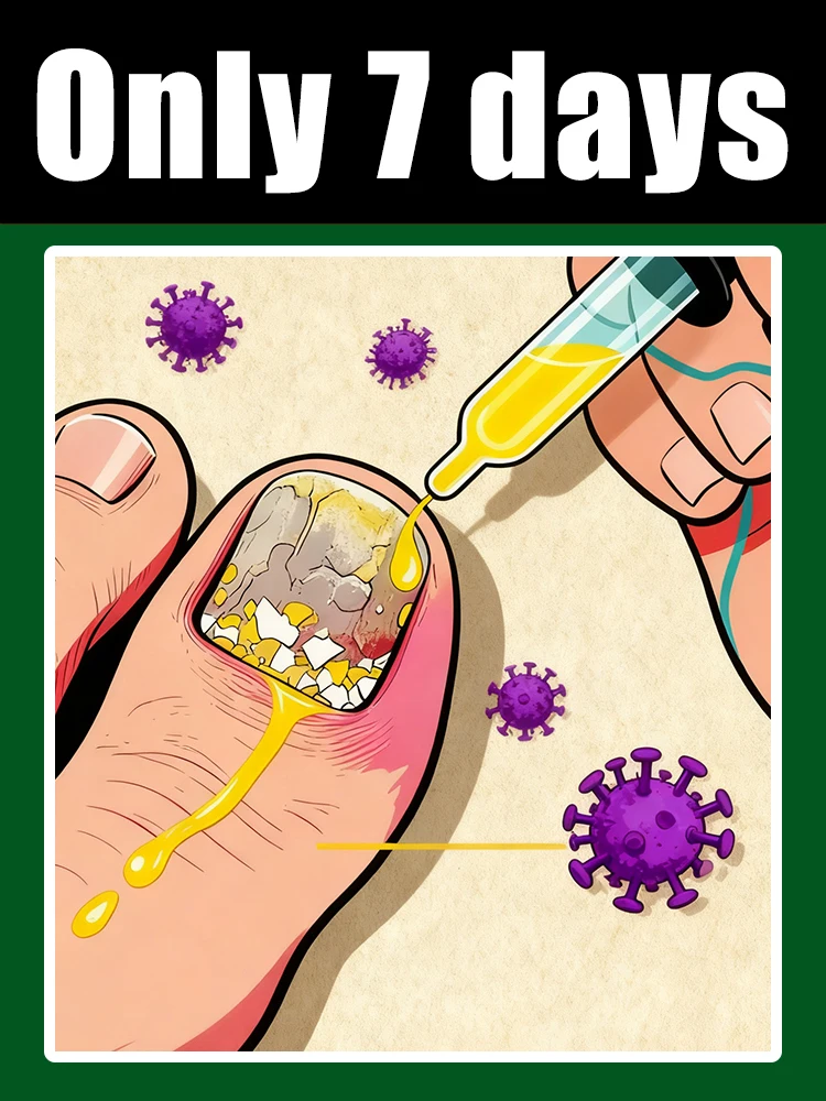 速攻浸透、爪が透明になり、真菌がなくなります。