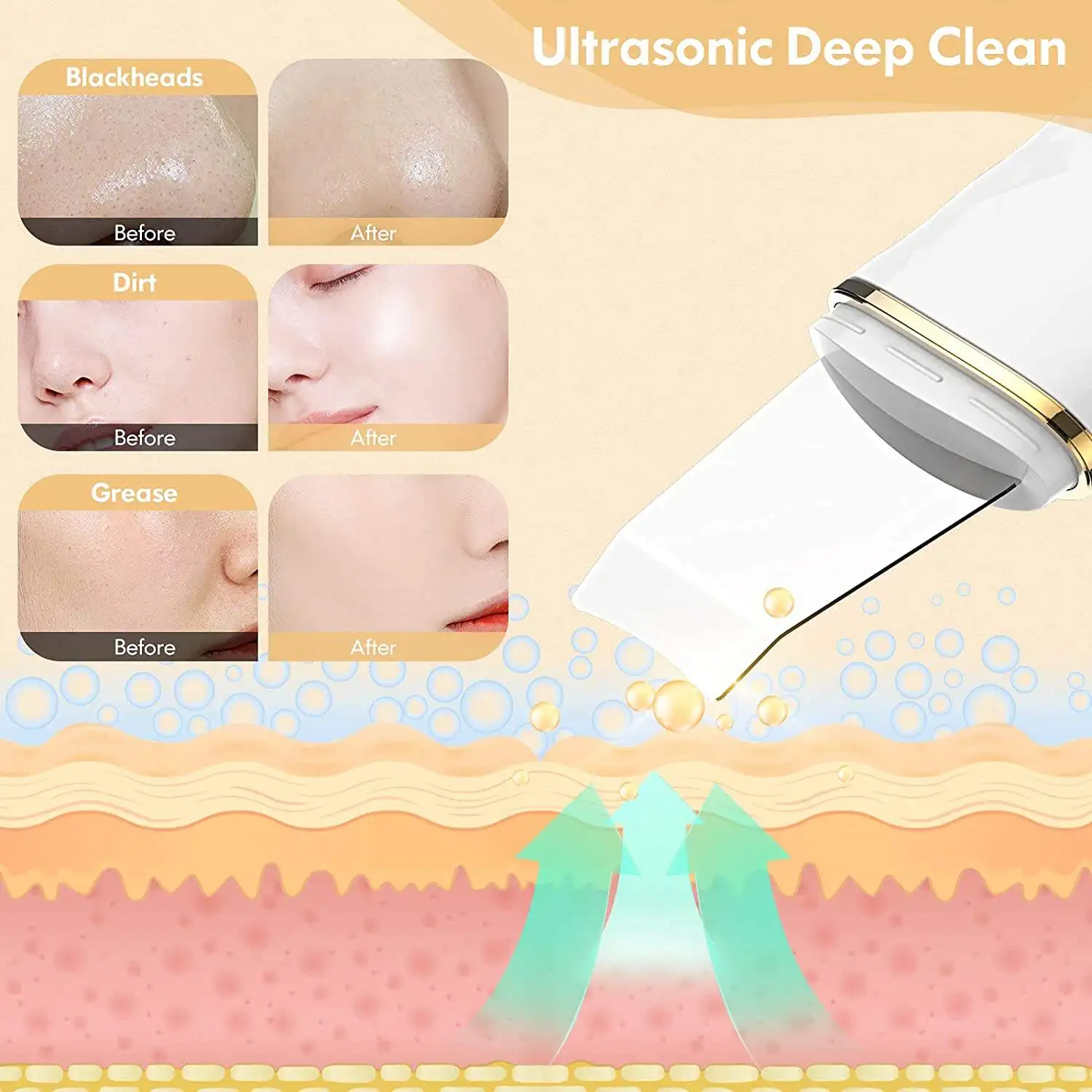 2024 travelling beauty care Pore Cleansing Face Sonic Peeling Heating Ultrasonic Skin Scrubber Vibration Face Spatula