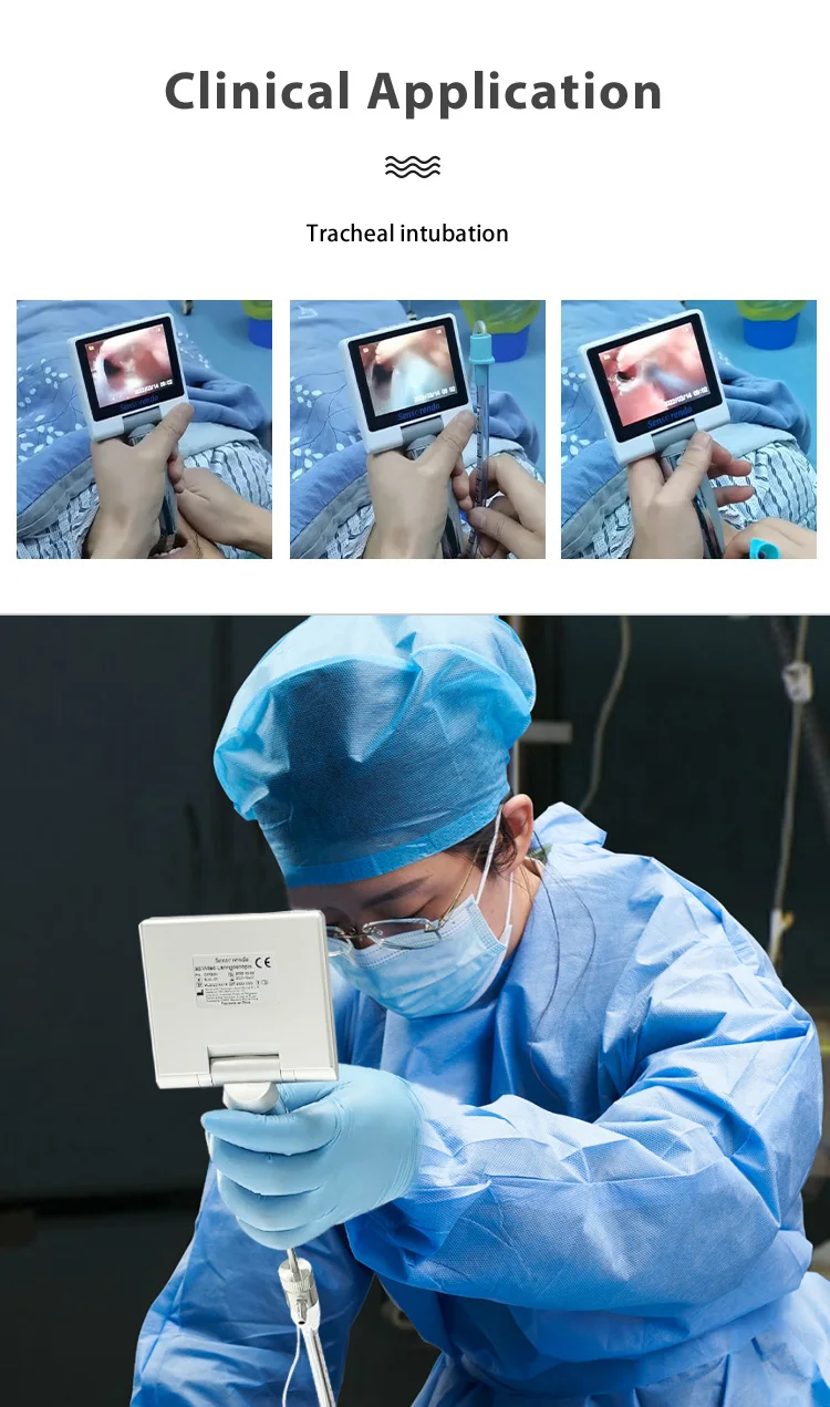 Laryngoskop Estilete