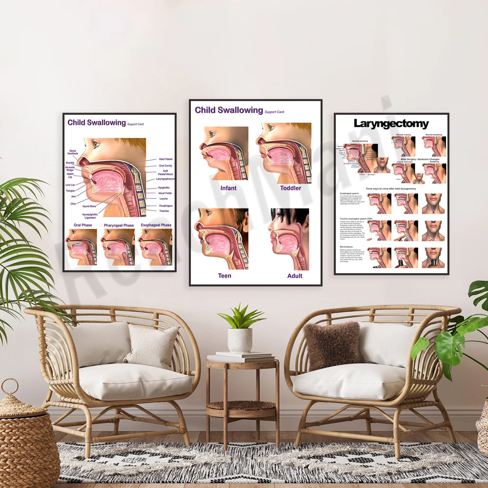 

Laryngectomy anatomy diagram for speech pathologists (SLP) otolaryngologists, swallowing anatomy for children, larynx poster