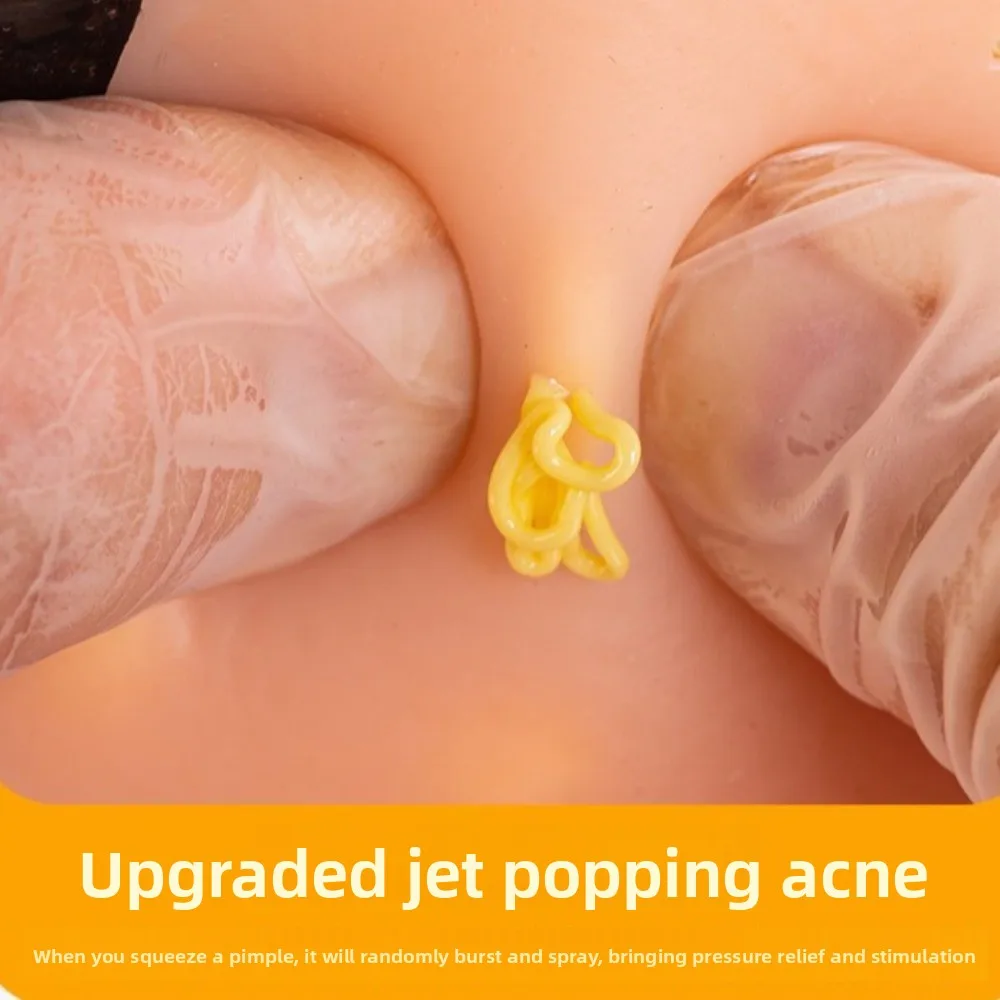 Stress Relief Refillable Pimple Popping Decompression Sensory Realistic Pus Burst Fidget Realistic Pus