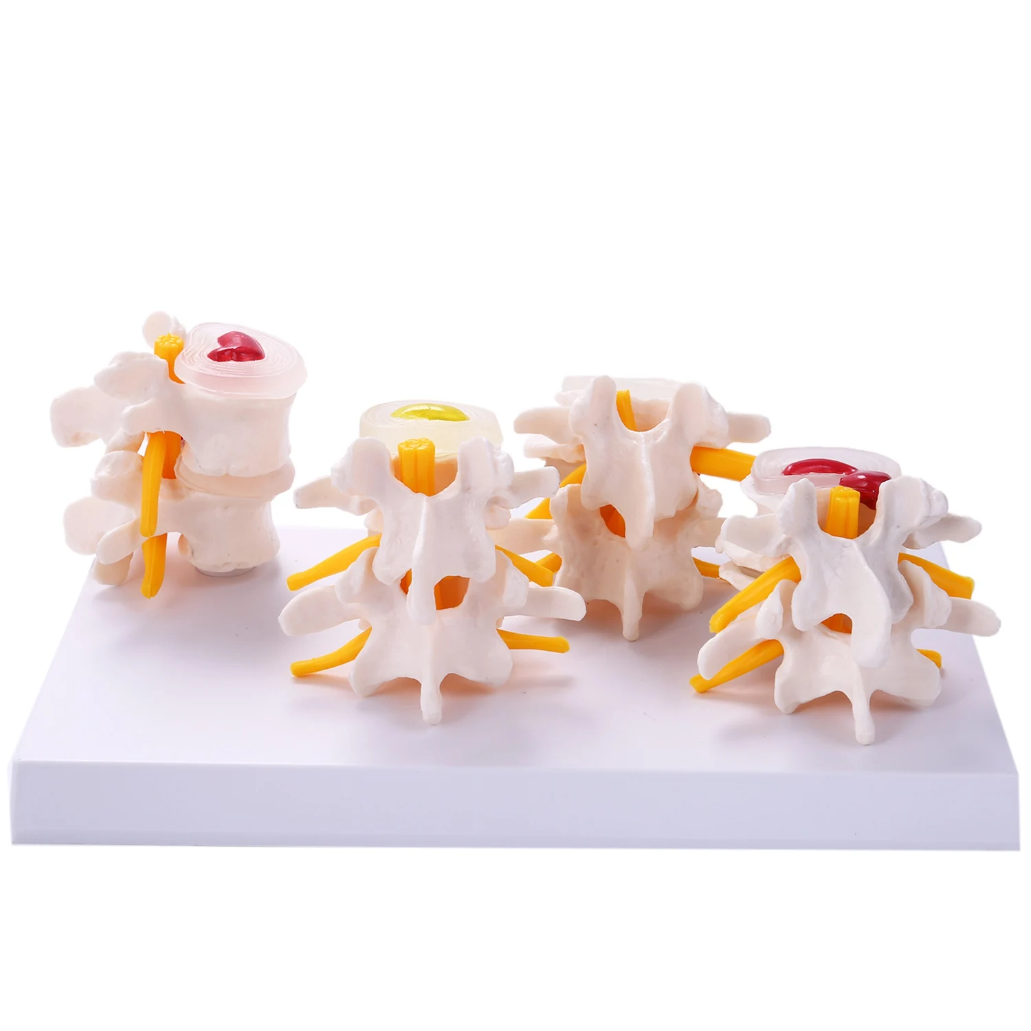 Human Anatomy Skeleton Spine 4- Lumbar Vertebral Model Brain Skull Traumatic Teaching Supplies