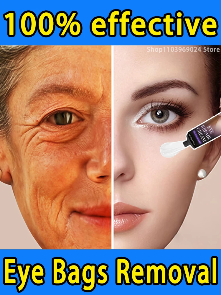 

Скажи прощайте проблему сумок под глазами и выглядит младшим