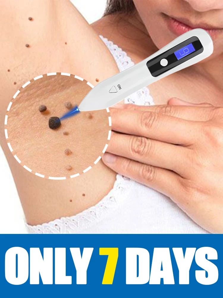 

2025 hot sale White light pen.Solve Moles and Wart Tool.