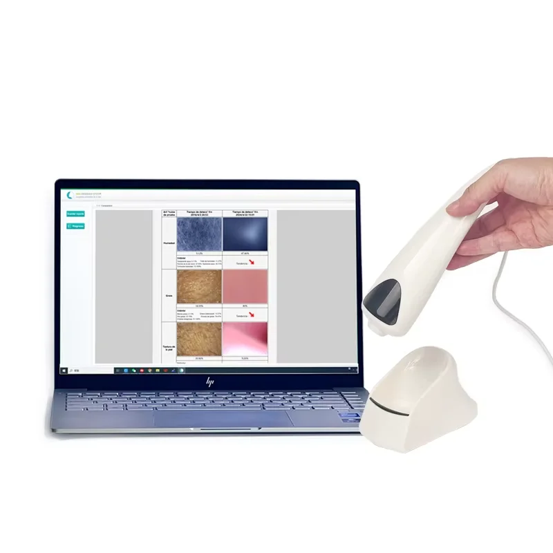 Scanner digital de pele 3d, detector profissional de diagnóstico de pele, analisador de pele facial, máquina de análise de rugas e óleo