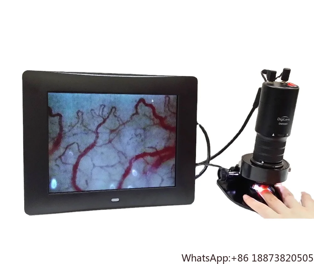 

DMX980 Microscope microcirculation Microvascular capillary microscope