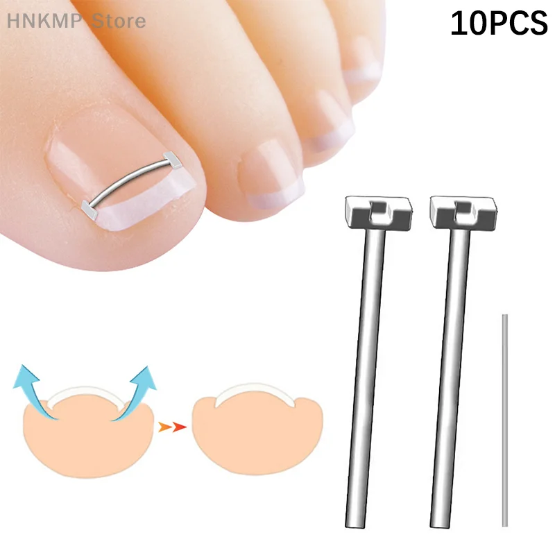 Corrector de uñas encarnadas para el cuidado de los pies, herramienta profesional de pedicura, tratamiento de uñas encarnadas, 10 piezas