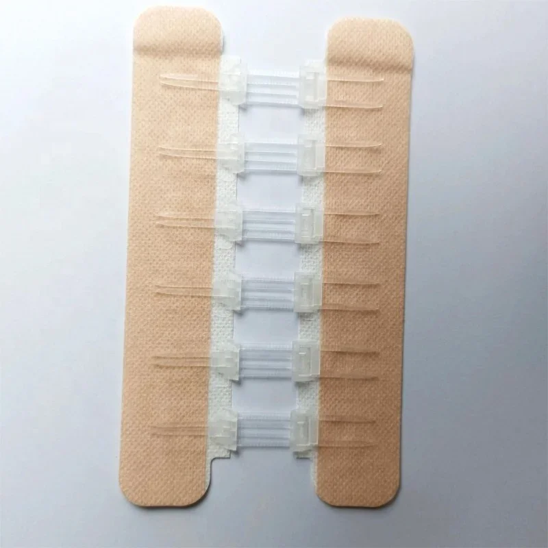 Factory Direct Supply Zip Stitch Single Package Medical Wound  Closure Device CE Surgical Sutures Wound Care 3 Years