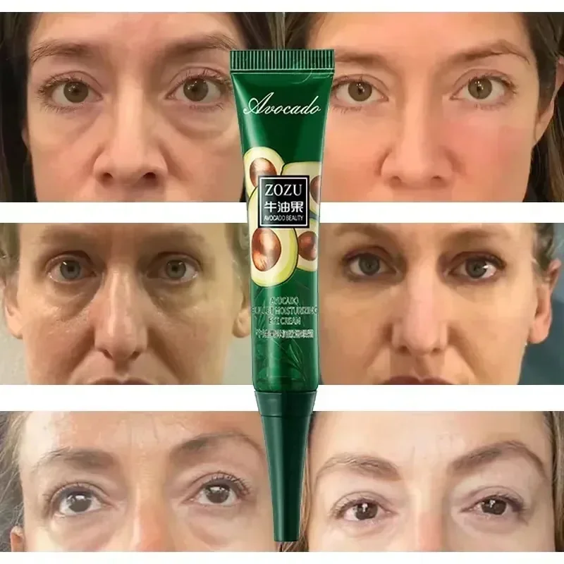 Instant Rimpel Verwijderen Oogcrème Vervagen Oog Fijne Lijn Anti Aging Donkere Kringen Zak Wallen Draai Ogen Huidverzorging Koreaanse Originele