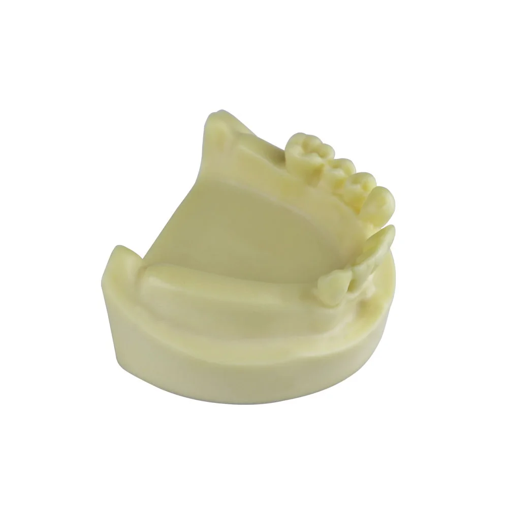 Lower Jaw Implant Model Missing Tooth Dental Teeth Model Practice Model  For Training Examation Studying Education Teaching Demo