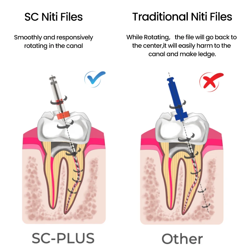 SOCO PLUS 6Pcs/Box Heat-Treated Rotary Nickel Titanium Endo Files Remarkable Anti-Breakage Strength Root Canal Preparation