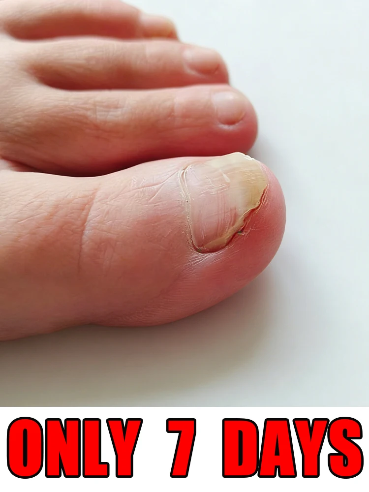 Sᴏᴏᴛʜᴇ ᴄʜᴀᴘᴘᴇᴅ ᴄᴜᴛɪᴄʟᴇs, ʙᴜɪʟᴅ ɢʀᴀᴄᴇғᴜʟ ᴀɴᴅ sᴏᴘʜɪsᴛɪᴄᴀᴛᴇᴅ ɴᴀɪʟ sʜᴀᴘᴇ.