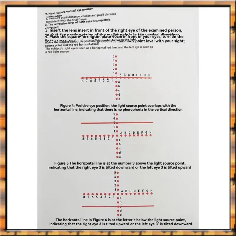A78K Neues Torrington Block AC/A Ophthalmic Strabismus Detection Tool Fornear-Eye Position Screening