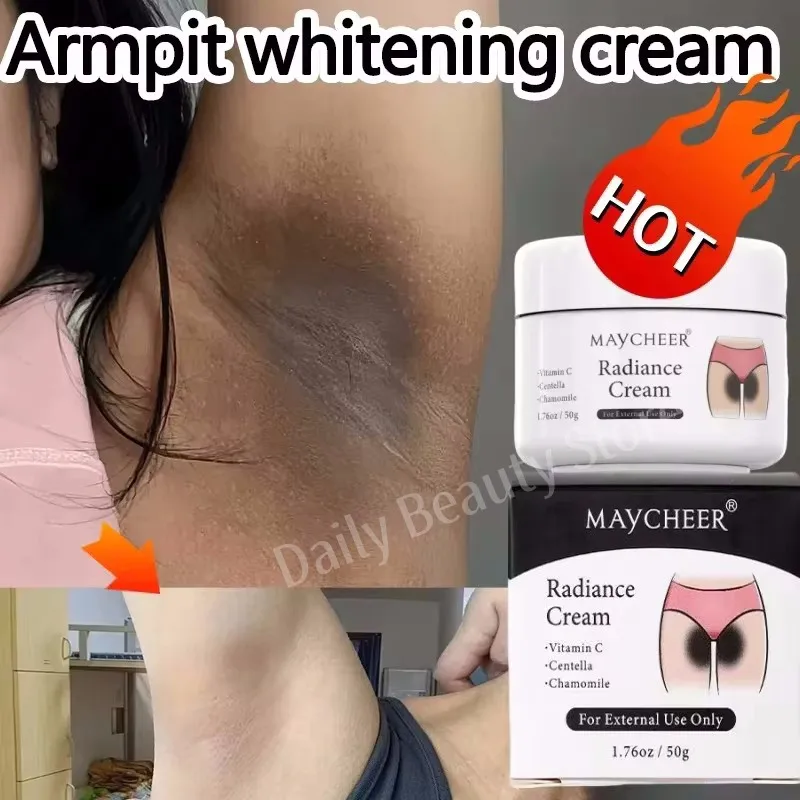 Whitening Cream Private Parts Underarm Bleaching Serum Whiten Butt Knee Brighten Inner Thigh Intimate Parts Dark Remove Melanin