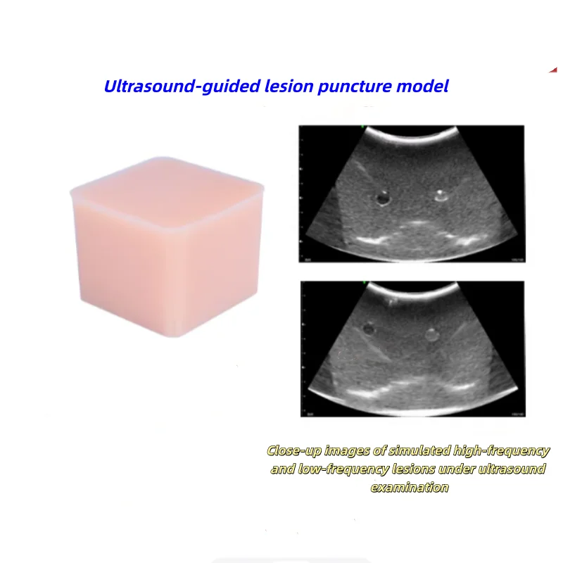 Ultrasound-guided lesion puncture model for targeted biopsy. B-ultrasound training for teaching and practice. Miniature portable