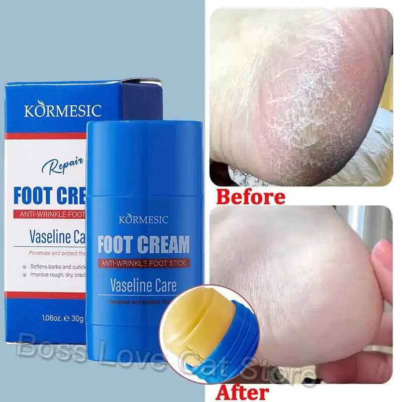 

Anti-wrinkle Foot Cream Stick Dry Cracked Feet Heel Gentle Exfoliation Softening Skin Ultra-Hydrating Hand Foot Care Cream 30g