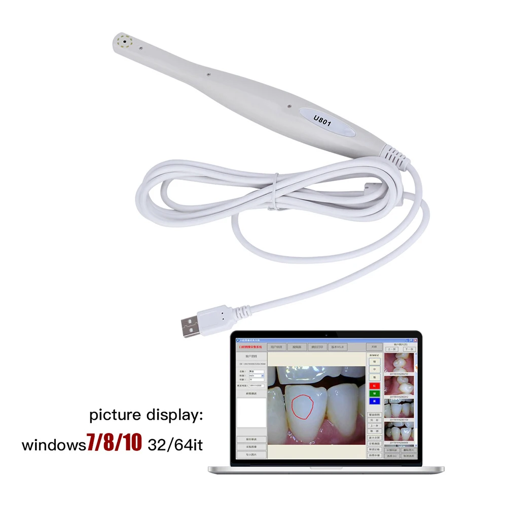 AZDENT Dental Digital Oral Endoscope Intraoral Camera With 8 White Cold LED Light for Oral Inspection USB 2M Cable