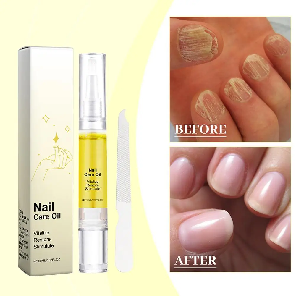 Roztwór do pielęgnacji paznokci Naturalna esencja do paznokci Fix Renew Nail Odbarwiony Szybko Uszkodzony Złamane Pęknięte Paznokcie Naprawa Formy Serum G5S9