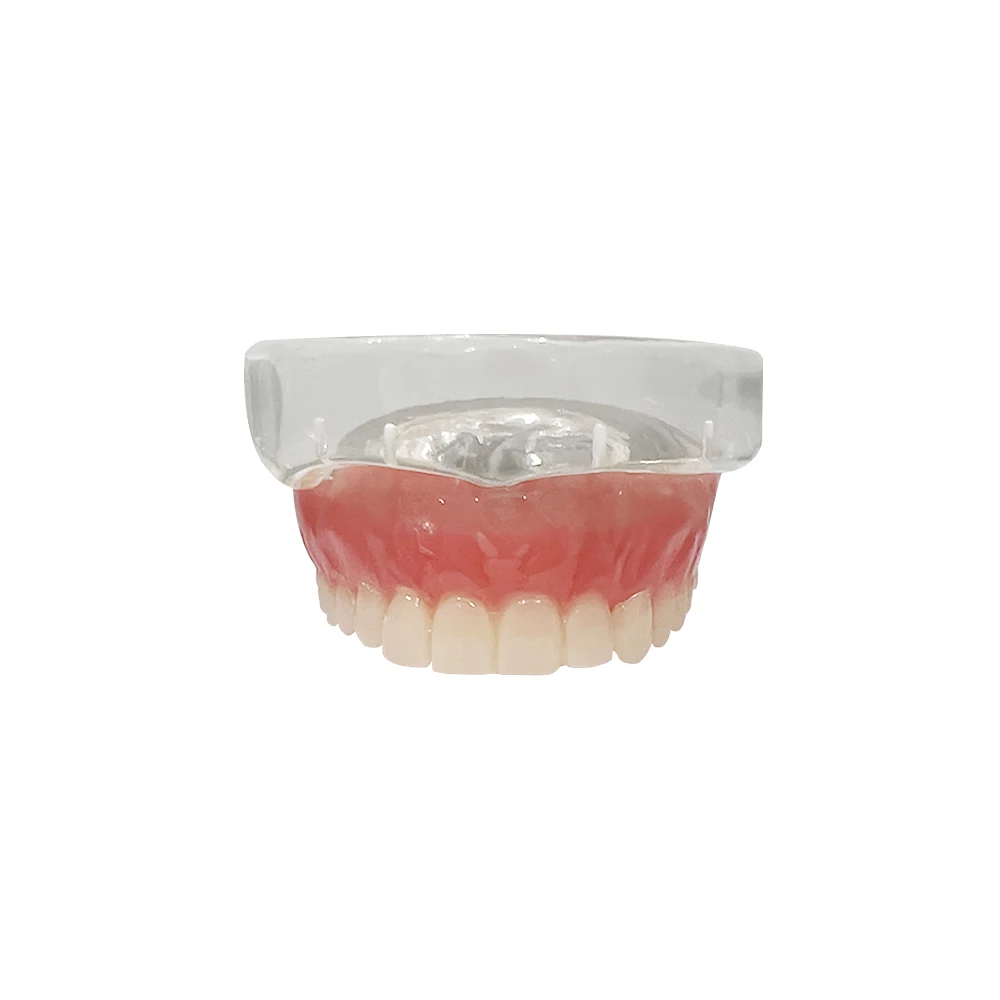 Dental Upper Overdenture Teeth Model Magnetic Adsorption Removable Superior Mandibular For Student Dentist Demo Study Teach