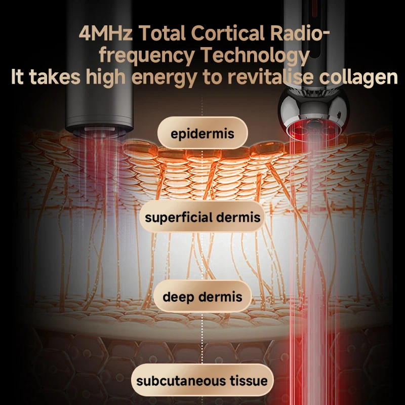 Apertar a pele por radiofrequência, levantar a remoção firme das rugas, aumentar o colágeno e a absorção, com poder 10W, RF avançado