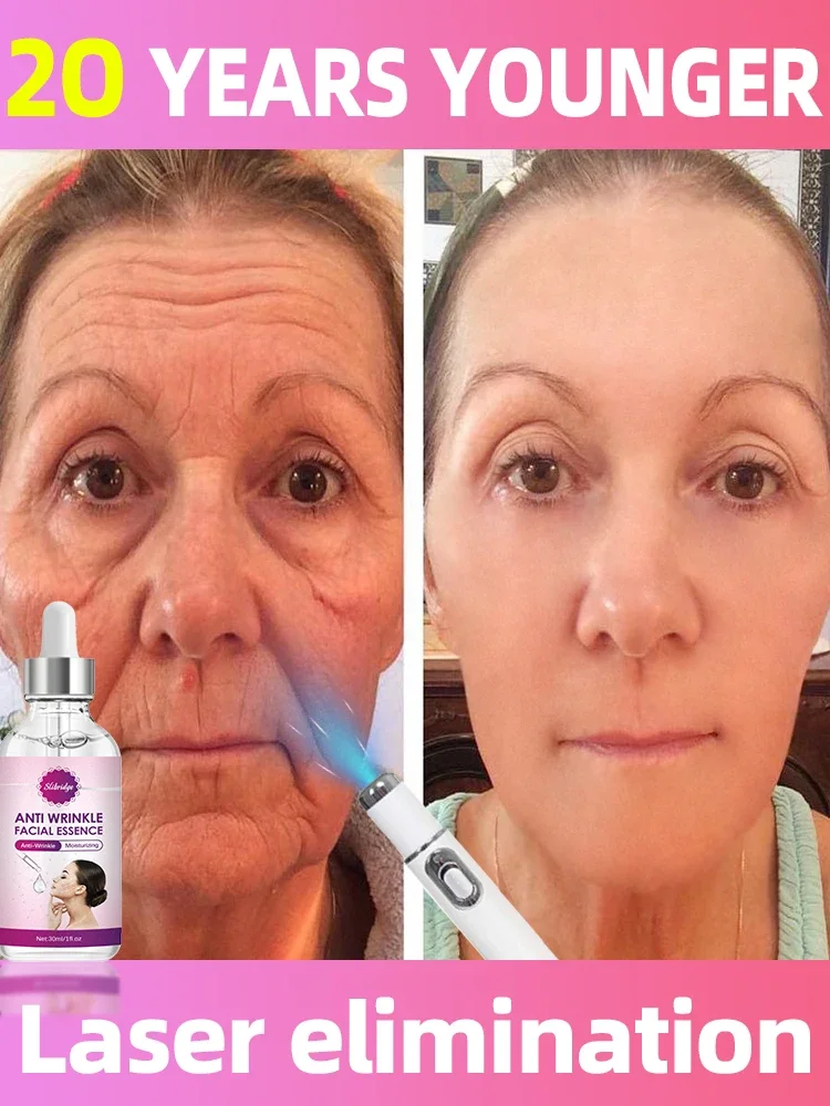 Solve all facial wrinkle problems