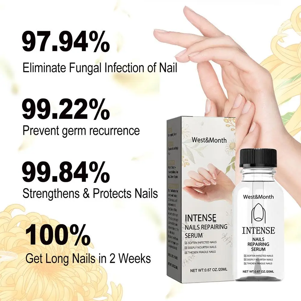 Nail Fungus Treatment Essence Soro, mão unhas, cutícula Gel, reparo do pé, remoção, Anti-Infect, V2Y5