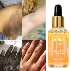 Dark Knuckles Fast Brighten Serum Elbows Hand Knuckle Brightening Serum Knee Black Skin Quickly Lighten Stains Remover Essence