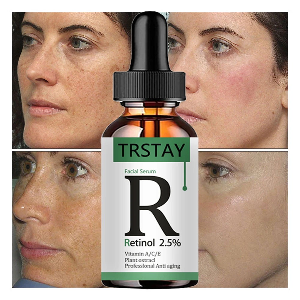 retinol 2.5% vitamin C/A facial essence reduces fine lines, tightens skin, and improves damaged skin