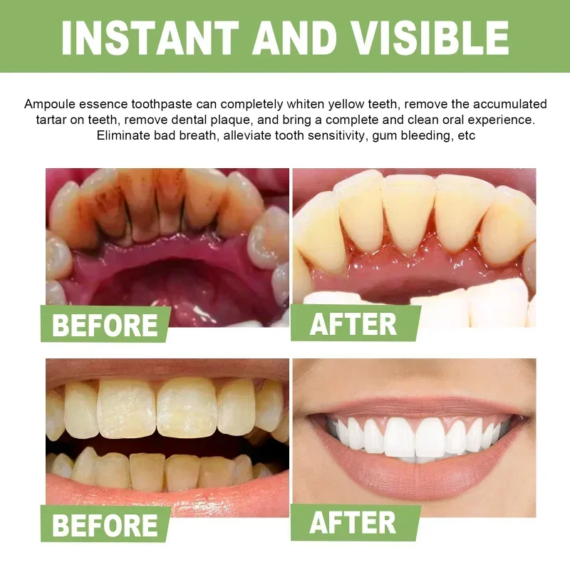 

Sdottor Teeth Essence Cleaning Tooth Stains Mouth Odor remove yellow Dental Plaque Brighten toothpaste Oral care serum Fresh Br