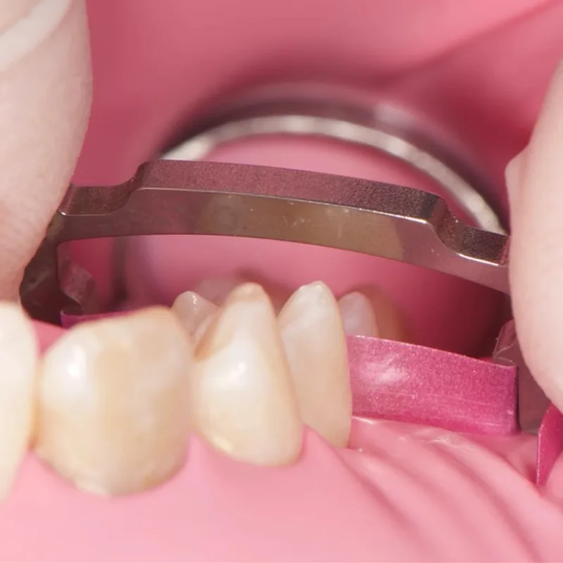 2Pcs/Set Dental Resin Polishing Strip Holder High / Low Crown Dentist Polishing Assistant Tools Resin Teeth Grinding Dental Tool