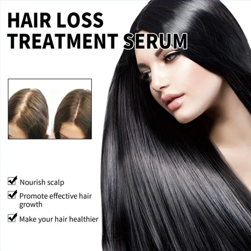 30ml Conditioner Conditioner Improves Hair Loss Care Nourishes Promotes Hair Growth Hair Tonic for Thick Fashion Repair Product