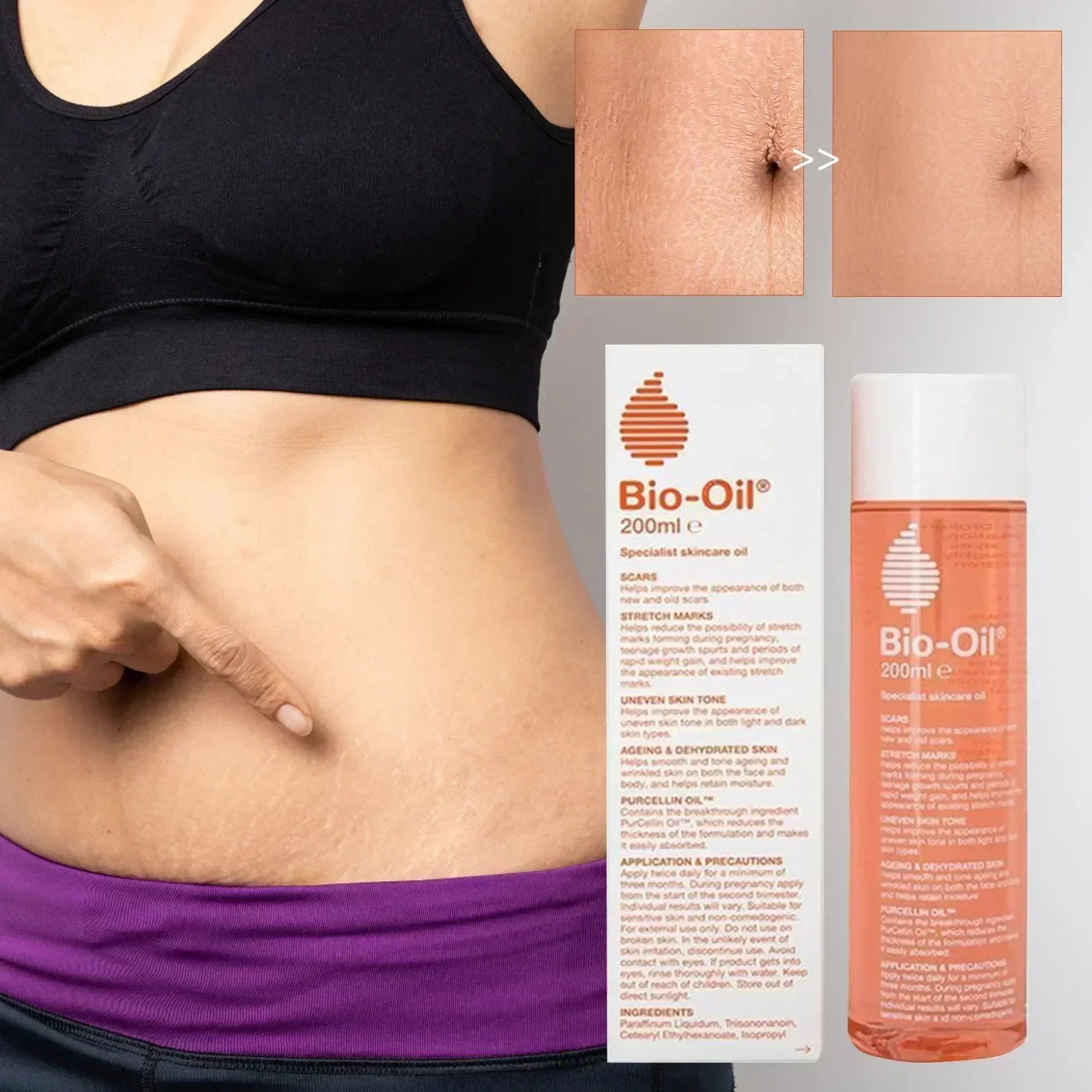 Bio-oil 200ml,Prevents and Fades Pregnancy Obesity Scars, Is Gentle and Non-irritating.