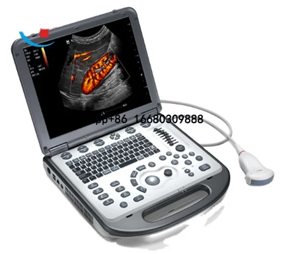 Medical Equipment USG Mindray M6 Color Portable Ultrasound Machine Ultrasound Machine Portable