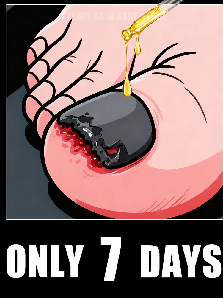 

Qᴜɪᴄᴋʟʏ ᴇʟɪᴍɪɴᴀᴛᴇ ғᴜɴɢᴜs ᴀɴᴅ ʀᴇsᴛᴏʀᴇ ʜᴇᴀʟᴛʜʏ ɴᴀɪʟs