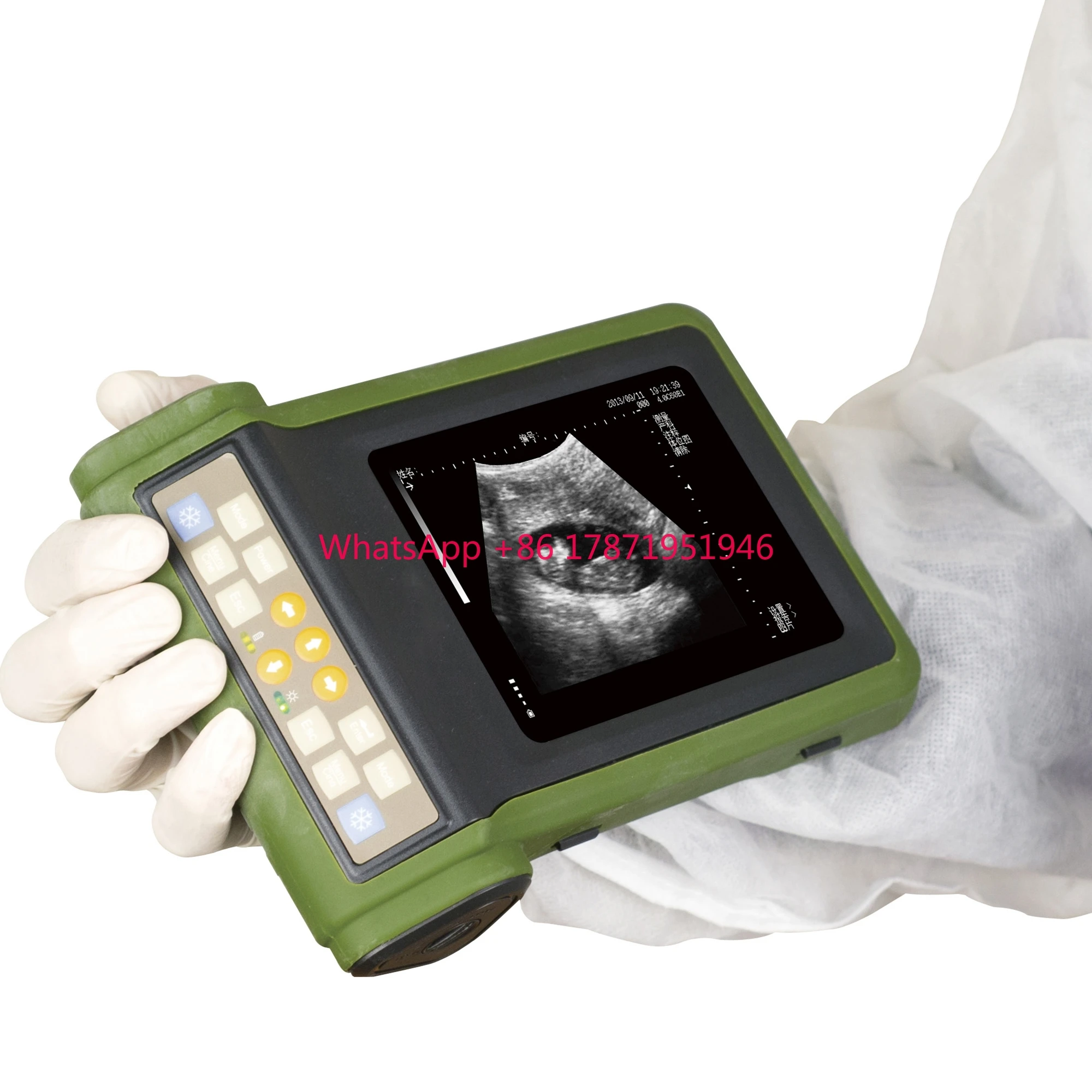 

ultrasonido ecografo rku10 Portable Vet Ultrasound Scanner/Machine With 6.5mhz Rectal Probe for KAIXIN RKU10