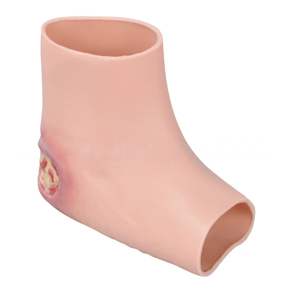 

Silicone Heel Wound Model Foot Sleeve Model for Medical Wound Care Training