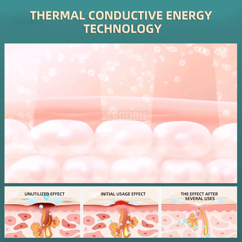 Dispositivo di sollevamento e rafforzamento dello strumento di rafforzamento del salone di bellezza domestico per la cura della pelle del viso